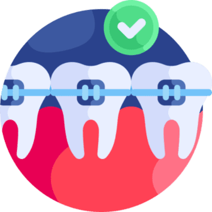 braces
